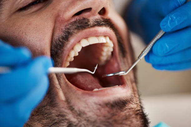 Best Emergency Dental Care for Broken or Chipped Teeth in West Lake Hills, TX
